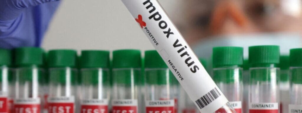Mpox : un cas confirmé à Dakar